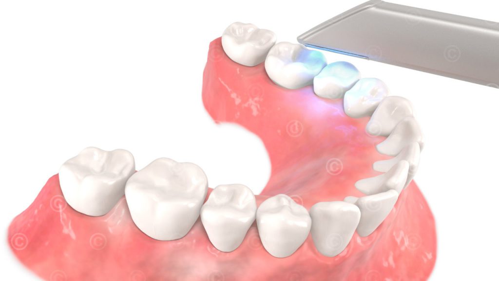 Animations Orthodontics - MedicalGraphics