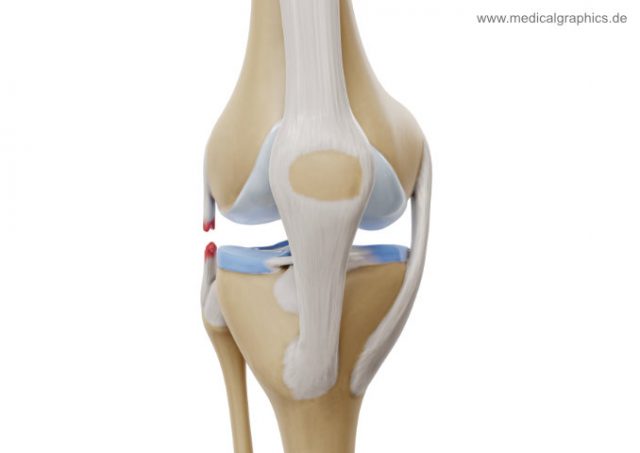 Lateral collateral ligament tear - front - MedicalGraphics